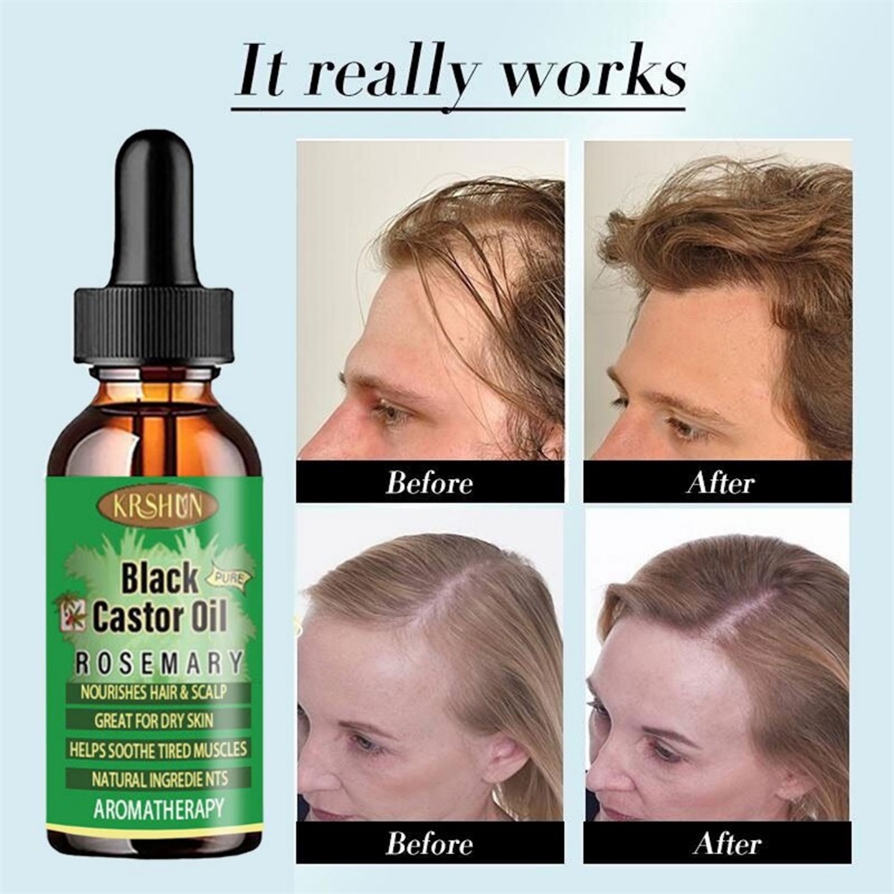 Coconut Oil Pull - Czarny olej rycynowy odżywia wzrost włosów
