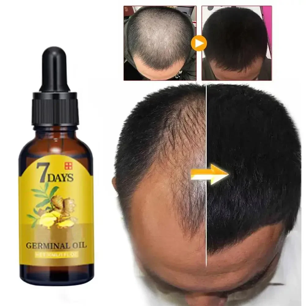 Coconut Oil Pull - Wzrost włosów Imbir Szybko rosnące włosy