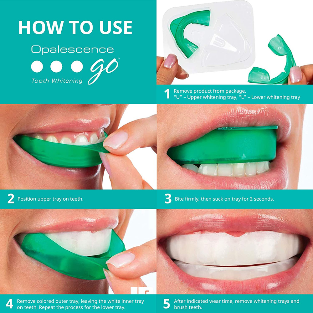 Nadtlenek wodoru do wybielania – Teeth Whitening With Trays recenzja i cena