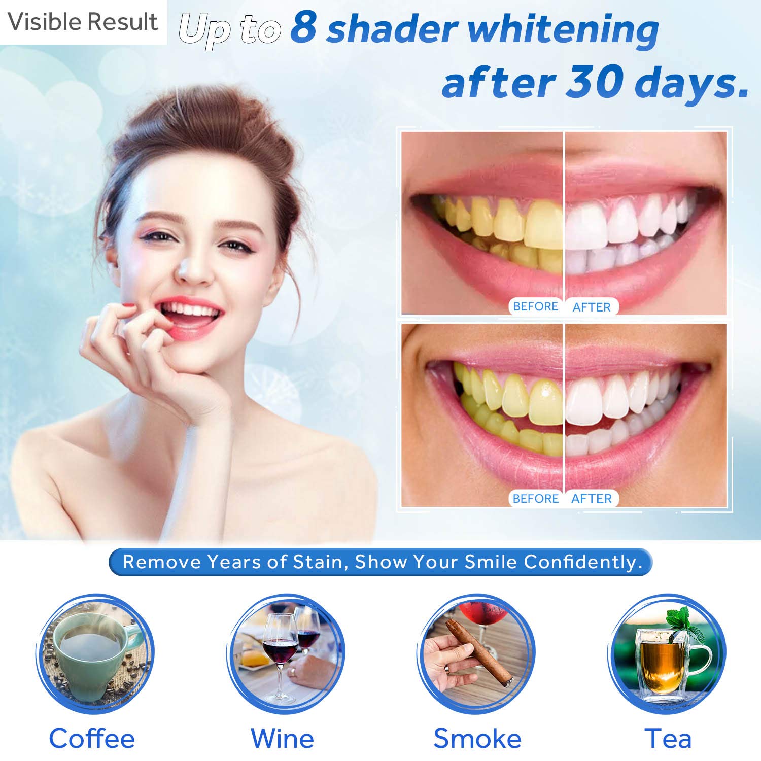 Żel do wybielania zębów w strz – Teeth Whitening With Trays recenzja i cena