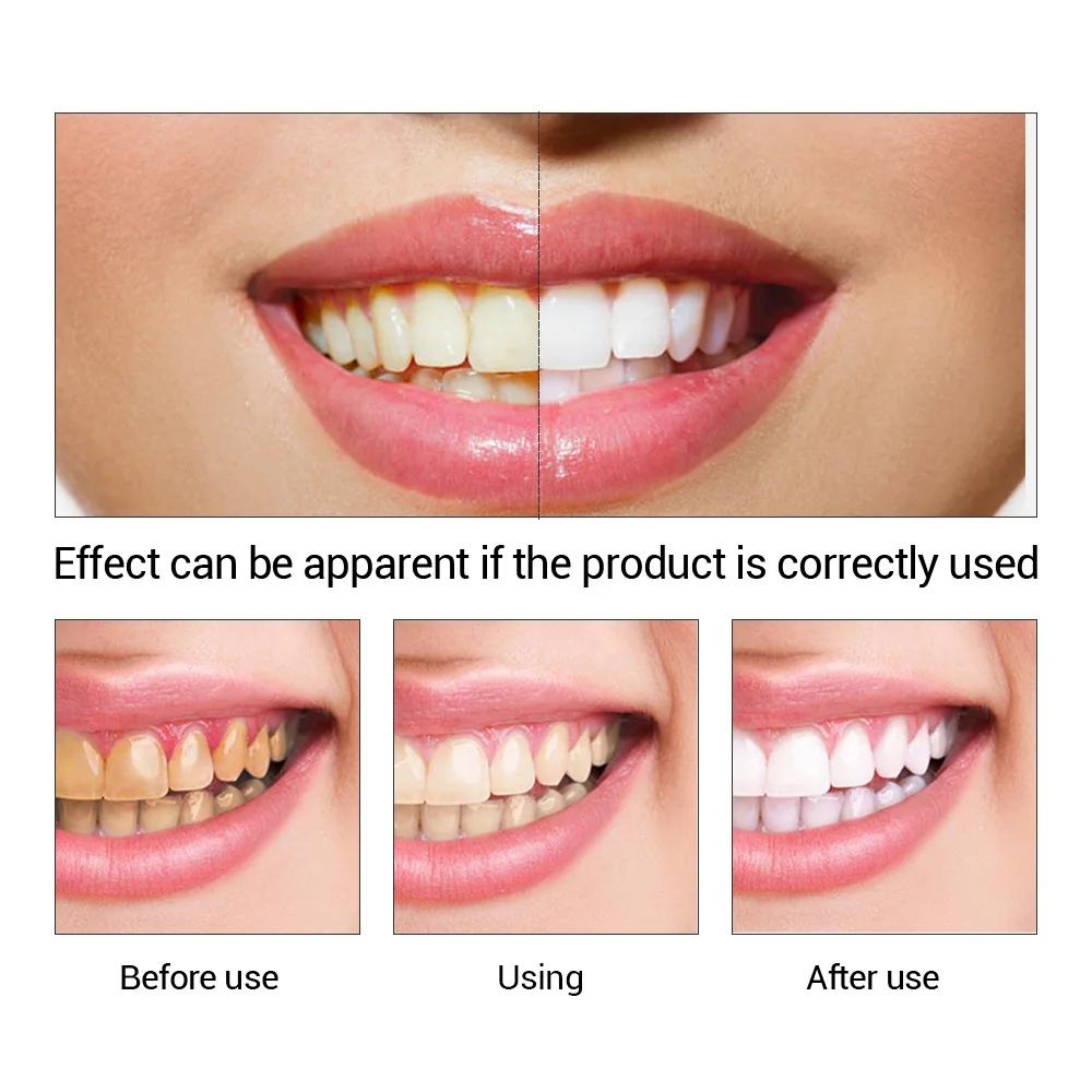 FTEENPLY esencja do wybielania – Teeth Whitening Powder recenzja i cena