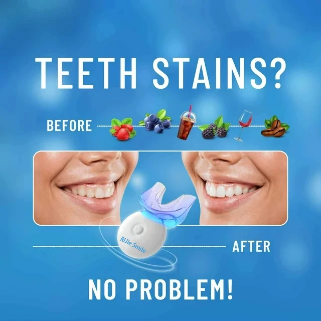Wysokiej jakości zestaw do czy – Teeth Whitening At Home Kit recenzja i cena