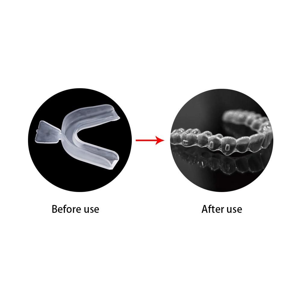 Ochraniacz na zęby na bruxizm, – Teeth Whitening With Trays recenzja i cena