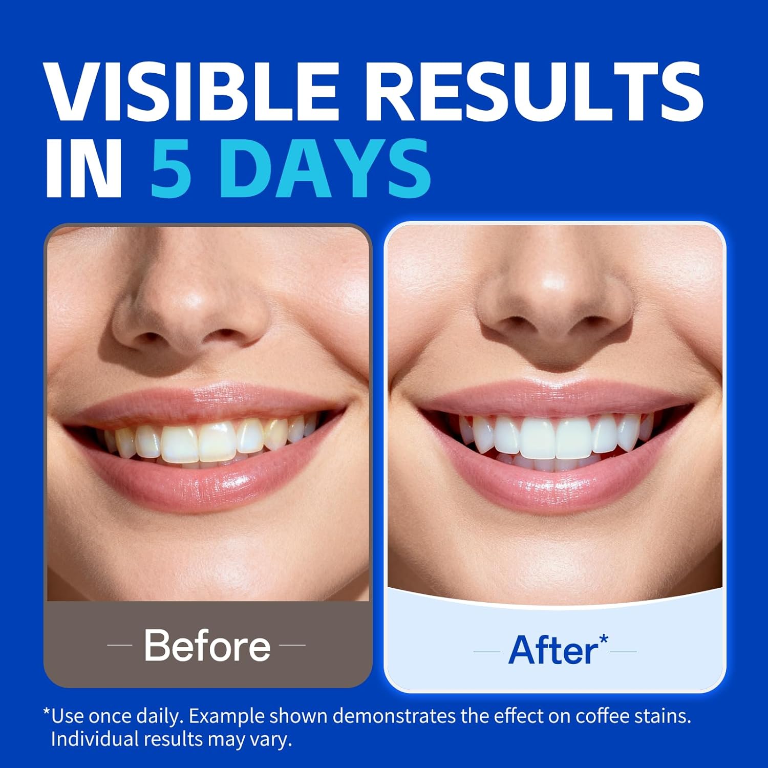 1/7 Par Pasków do Wybielania Z – Teeth Whitening Strips Crest recenzja i cena