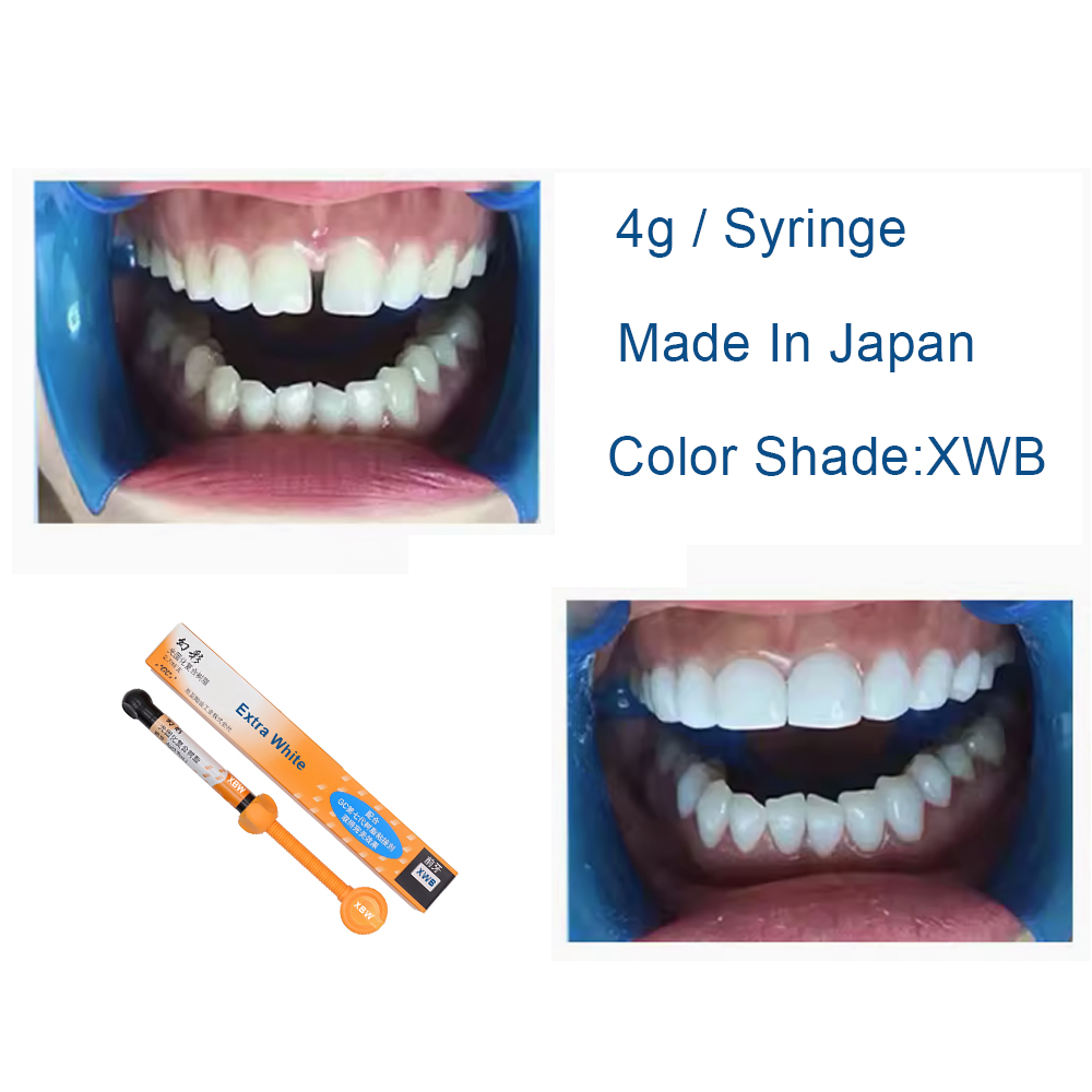 Kompozyt dentystyczny Extra Wh – Teeth Whitening Professional recenzja i cena